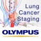The LC Staging reflects and visualizes the 7th and the 8th edition of guidelines for TNM classification and staging of lung cancer, which were developed by the International Staging Committee of the International Association for the Study of Lung Cancer (IASLC)