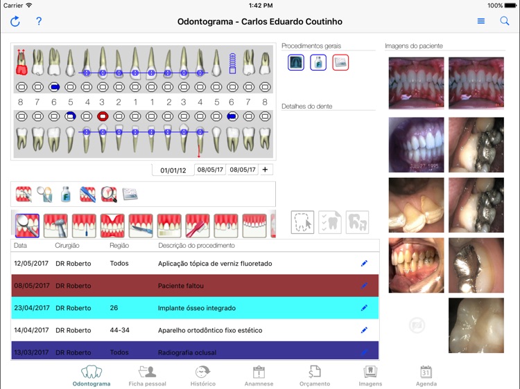 EasyDental 8