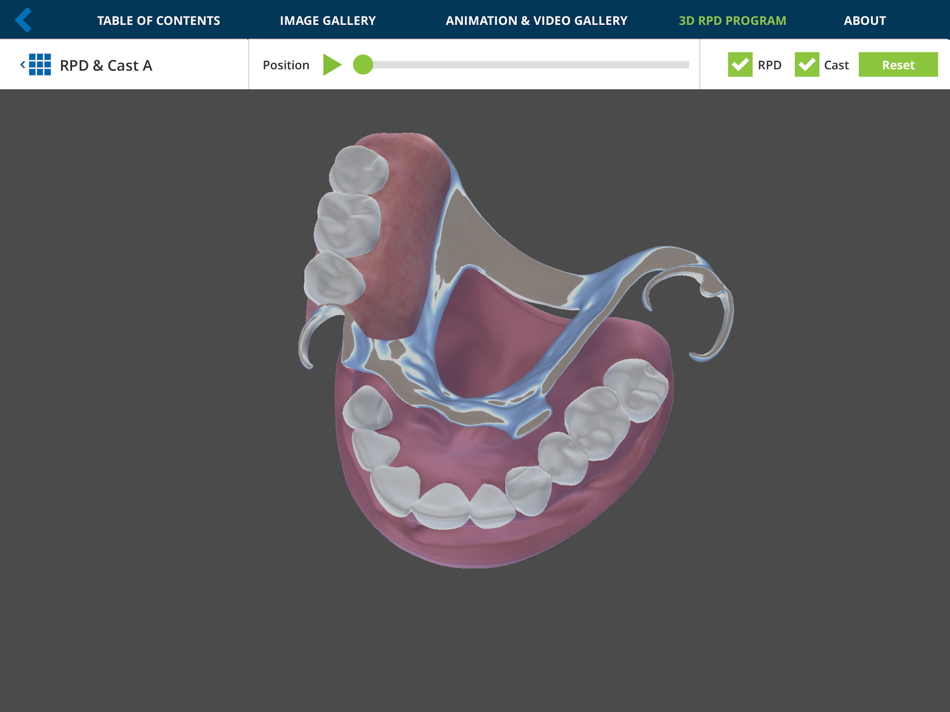 #1. Removable Partial Dentures (iOS) By: eHuman Inc.