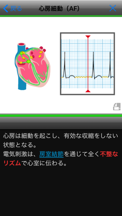 らくらく心電図トレーニング（英語モード付き）スクリーンショット