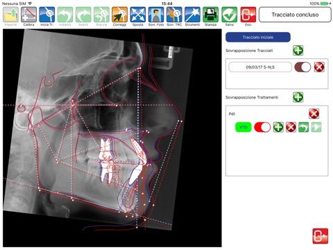 Delta-Dent screenshot 3