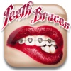 Fake Braces Photo Montage – Stickers for Pictures