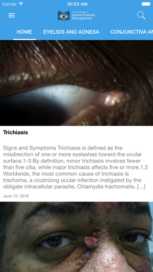 Ocular Disease Handbook(圖2)-速報App