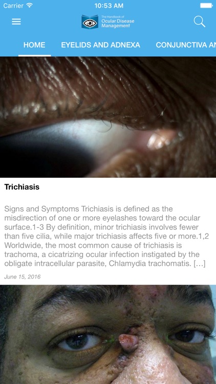 Ocular Disease Handbook