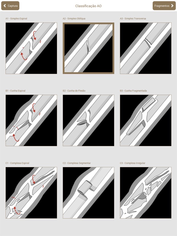 Osteotraumaのおすすめ画像2