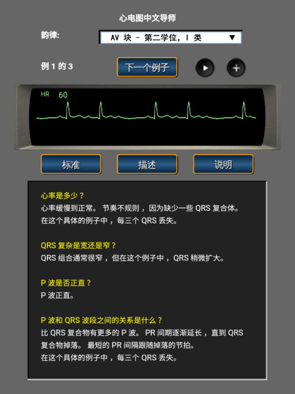 Screenshot #5 pour 心电图中文导师