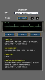 心电图中文导师 problems & solutions and troubleshooting guide - 1