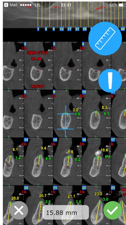 CBCT Ruler