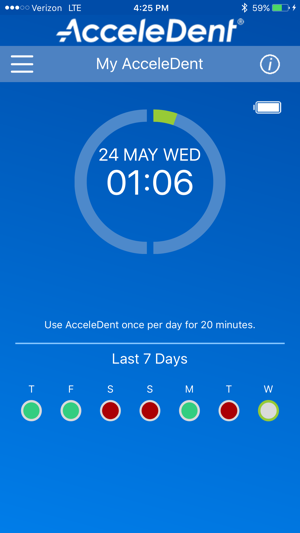 AcceleDent App(圖3)-速報App