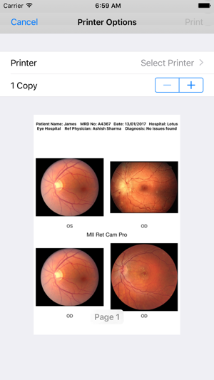 MII Ret Cam Pro-Patient Pofile(圖5)-速報App