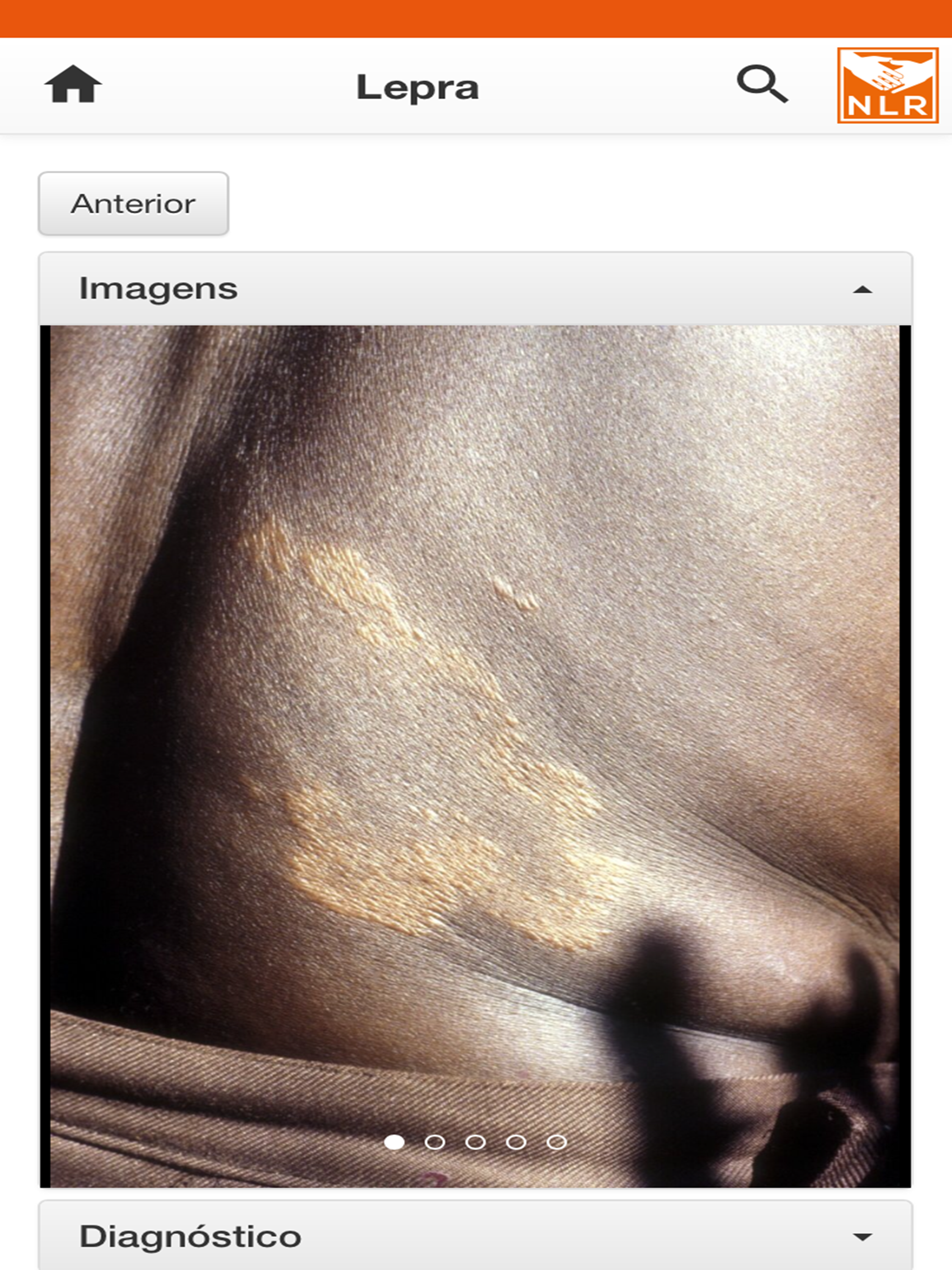 SkinApp MZ