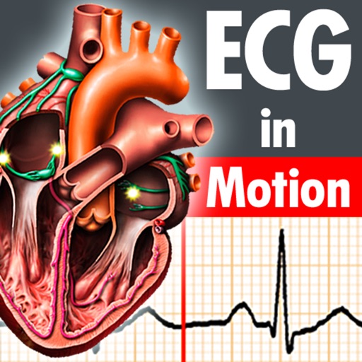ECGinMotion HD