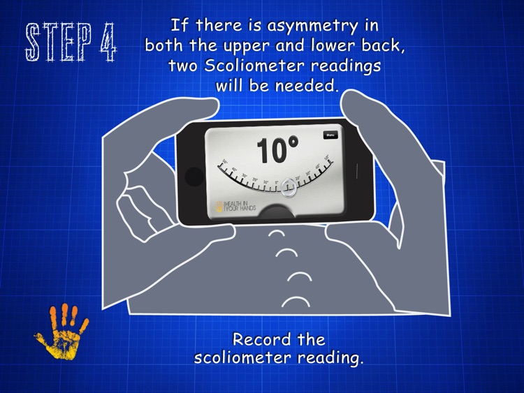 Scoliometer HD screenshot-4