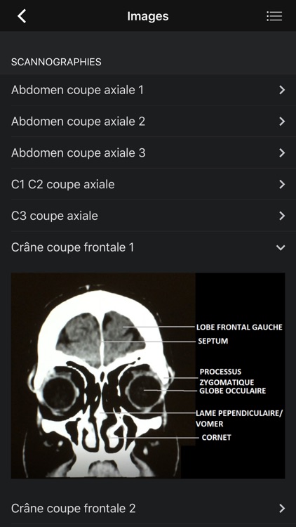 Fiches Manip screenshot-4
