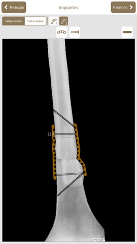 Osteotraumaのおすすめ画像4