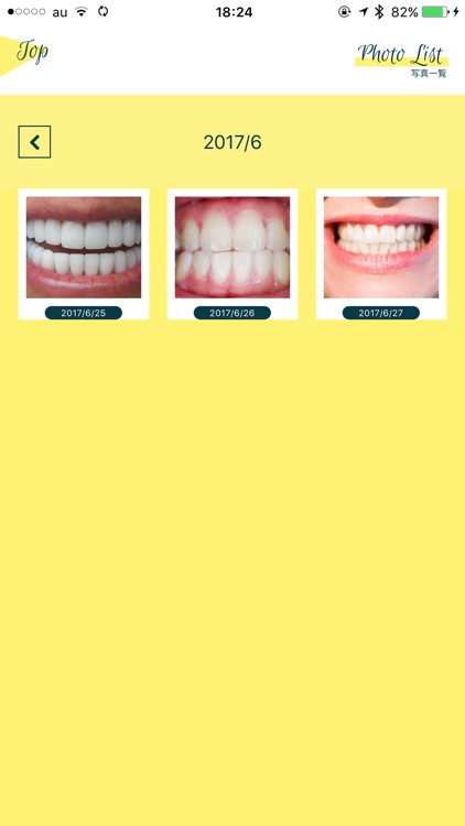 Smile Cosmetique  白い歯日記 screenshot-4