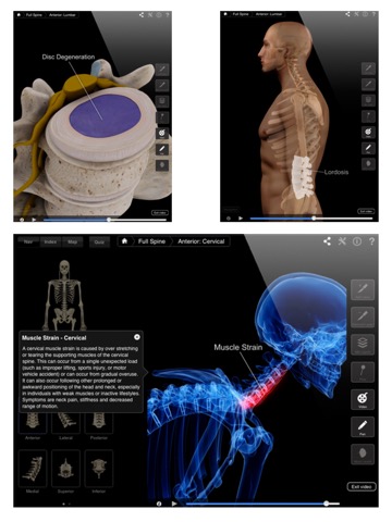 Spine Pro IIIのおすすめ画像3