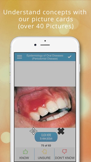 NBDE - Dental Public Health(圖2)-速報App