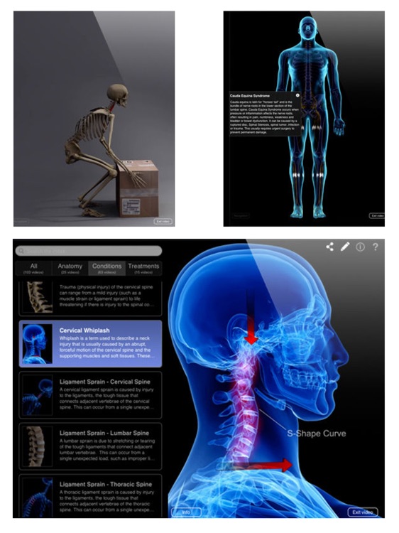 Orthopedic Patient Education