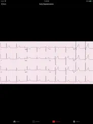 ecgsource ipad resimleri 2
