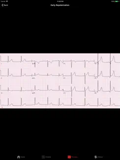 ECGsource iPad image 2