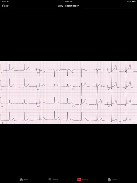 ECGsource