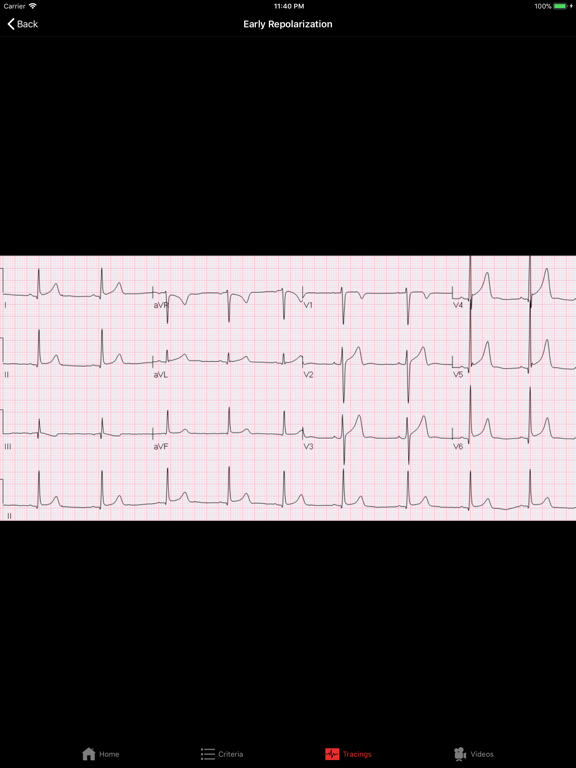 Screenshot #5 pour ECGsource