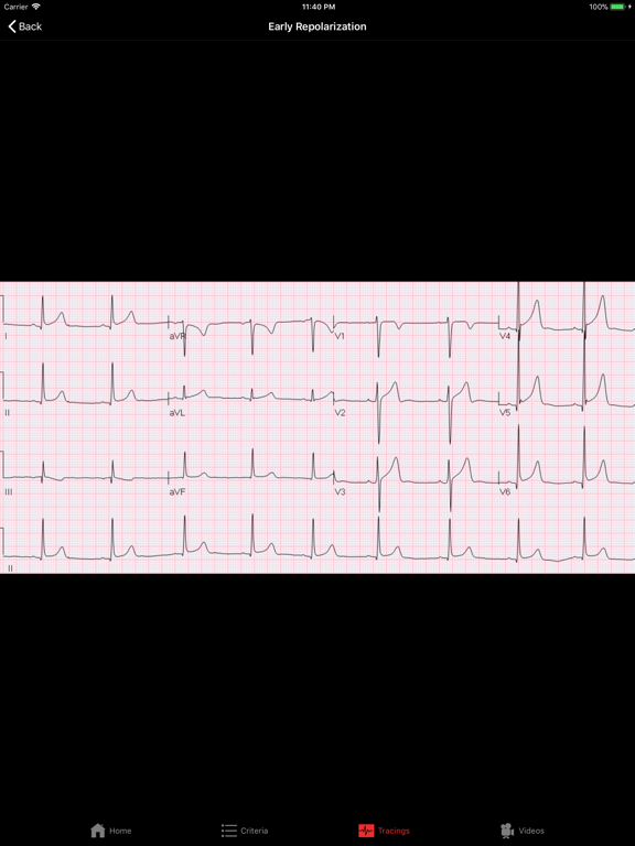 ECGsourceのおすすめ画像2