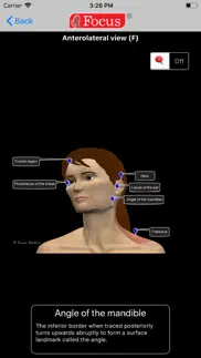 head and neck problems & solutions and troubleshooting guide - 3