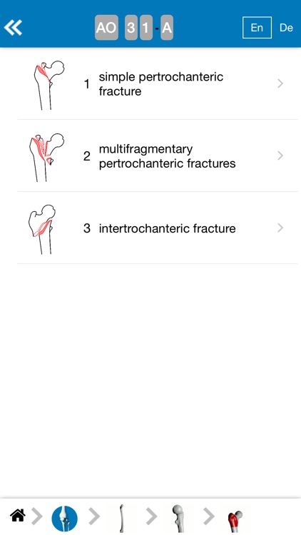 Fracture 3D