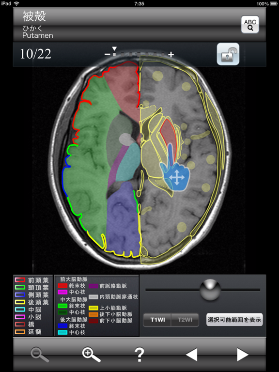 Screenshot #5 pour 断面図ウォーカー脳MRI