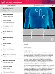 heart murmurs pro ipad resimleri 1