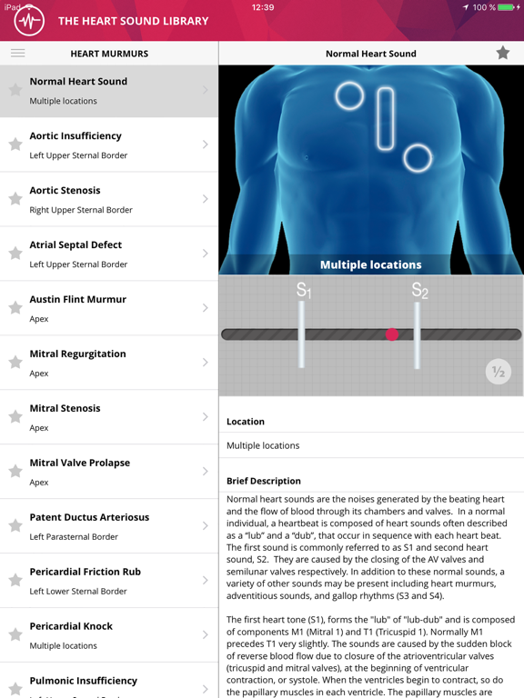 Heart Murmurs Proのおすすめ画像1
