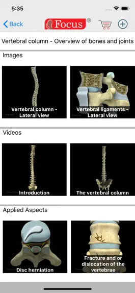 Game screenshot Back and Spinal cord hack
