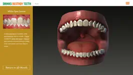 Game screenshot Drinks Destroy Teeth hack