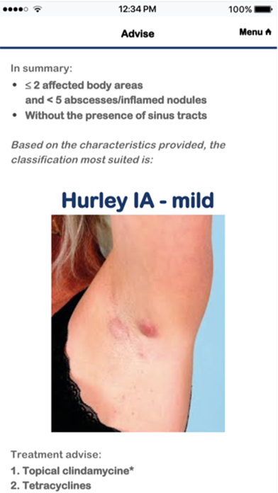 Hidradenitis Suppurativa App Screenshot