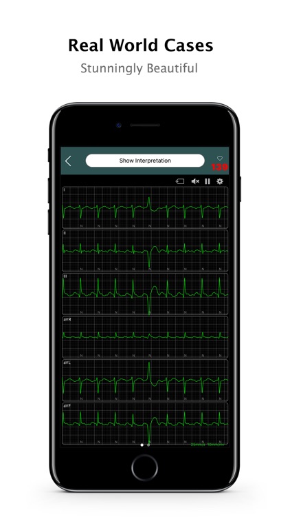 ECG Pro - Cases, Exams, Compendiums for CME & EMT