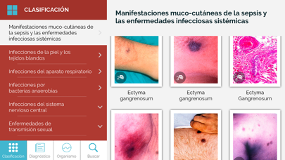 Screenshot #2 pour Dicc. Enfermedades infecciosas