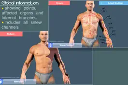Game screenshot Easy Acupuncture 3D -FULL hack