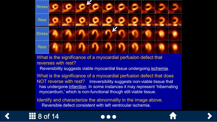 Basic Radiology - Secondlook screenshot-3