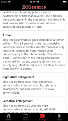 ECGsource screenshot 3
