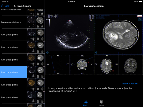 Sonographic Brain Atlas screenshot 4