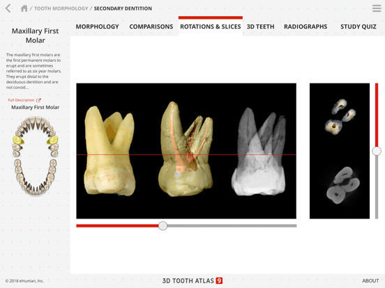 Tooth Atlas 9 iPad screenshot 6 - Education app