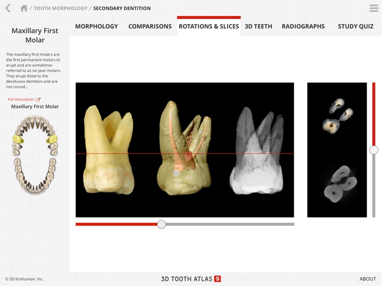 Tooth Atlas 9 screenshot-5
