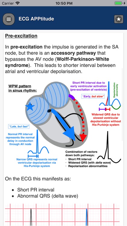 ECG APPtitude