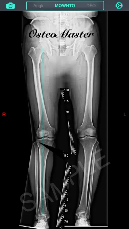 OsteoMaster screenshot 1 of 5