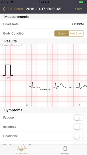 HUINNO MEMO for ECG(圖3)-速報App