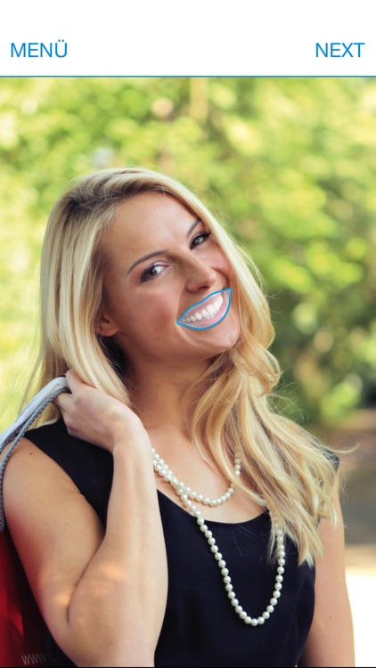 WHITEsmile Tooth Whitening