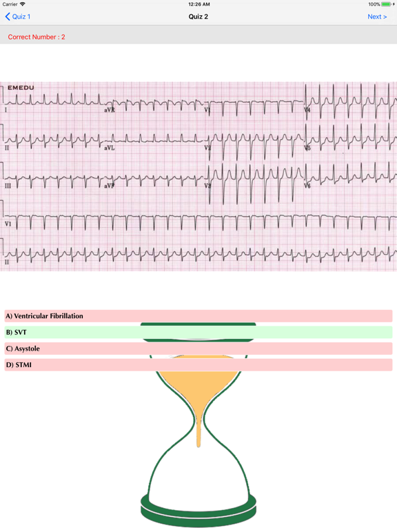 ECG QUIZ START iPad screenshot