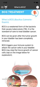 BCG Treatment screenshot #3 for iPhone